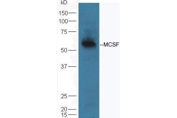 M-CSF/CSF1 antibody  (AA 201-300)
