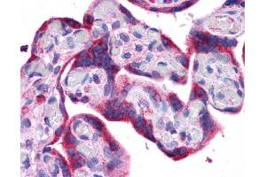 Immunohistochemistry (IHC) image for anti-ATG5 Autophagy Related 5 (ATG5) (C-Term) antibody (ABIN2785620) (ATG5 antibody  (C-Term))