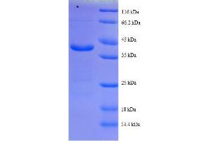 Cytochrome C Oxidase Subunit Va (COX5A) (AA 42-150), (full length) protein (GST tag) (COX5A Protein (AA 42-150, full length) (GST tag))