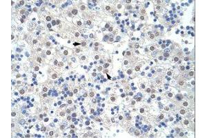 Image no. 1 for anti-Pre-mRNA Branch Site Protein p14 (SF3B14) (AA 90-139) antibody (ABIN203256) (Pre-mRNA Branch Site Protein p14 (SF3B14) (AA 90-139) antibody)