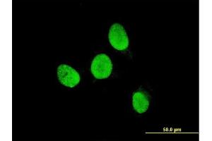 Immunofluorescence of monoclonal antibody to TESK2 on HeLa cell. (TESK2 antibody  (AA 405-542))