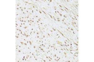 Immunohistochemistry (Paraffin-embedded Sections) (IHC (p)) image for anti-Small Nuclear Ribonucleoprotein Polypeptide A (SNRPA) (AA 1-282) antibody (ABIN6148210)