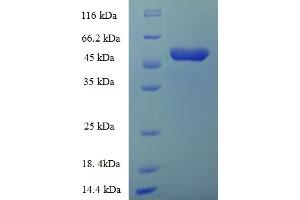 SDS-PAGE (SDS) image for Acyl-CoA Binding Domain Containing 4 (ACBD4) (AA 1-305), (full length) protein (His-SUMO Tag) (ABIN5711519)