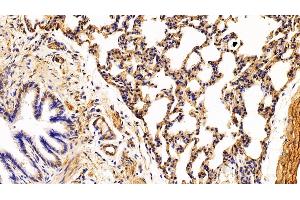 Immunohistochemistry (IHC) image for anti-Caveolin 1, Caveolae Protein, 22kDa (CAV1) (AA 2-105) antibody (ABIN7431326)