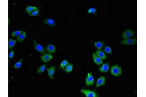 Immunofluorescence (IF) image for anti-Leupaxin (LPXN) (AA 1-300) antibody (ABIN7158308)