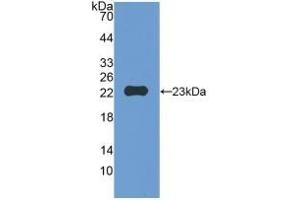 Detection of Recombinant MMP12, Mouse using Polyclonal Antibody to Matrix Metalloproteinase 12 (MMP12) (MMP12 antibody  (AA 294-473))