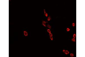 ABIN6268808 staining MCF-7 cells by IF/ICC. (HNRNPL antibody  (N-Term))