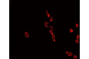 ABIN6268808 staining MCF-7 cells by IF/ICC.