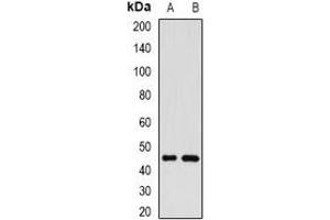 Western blot analysis of GP73 expression in SKOV3 (A), SHSY5Y (B) whole cell lysates.