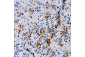 Immunohistochemistry of paraffin-embedded rat pancreas using CYP24 antibody (805) at dilution of 1:200 (40x lens). (CYP24A1 antibody  (AA 36-448))