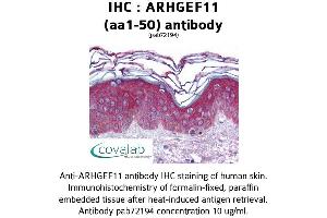 Image no. 1 for anti-rho Guanine Nucleotide Exchange Factor (GEF) 11 (ARHGEF11) (AA 1-50) antibody (ABIN1731940) (ARHGEF11 antibody  (AA 1-50))