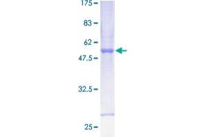 Image no. 1 for CS (AA 1-264) protein (GST tag) (ABIN1350469) (CS (AA 1-264) protein (GST tag))