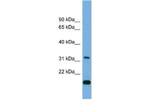 WB Suggested Anti-CTDSP2 Antibody Titration: 0. (CTDSP2 antibody  (Middle Region))