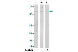 Western blot analysis of extracts from LoVo cells (Lane 1) and A-549 cells (Lane 2 and lane 3), using JAKMIP2 polyclonal antibody .