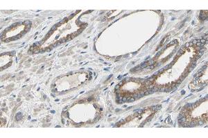 ABIN6277549 at 1/100 staining Human prostate tissue by IHC-P. (Cullin 5 antibody  (Internal Region))
