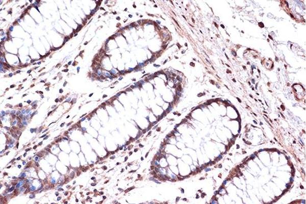 KIF4A antibody