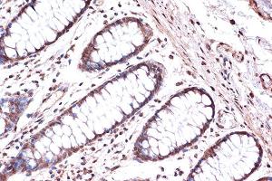Immunohistochemistry of paraffin-embedded human colon using KIF4A Rabbit mAb (ABIN7268134) at dilution of 1:100 (40x lens). (KIF4A antibody)
