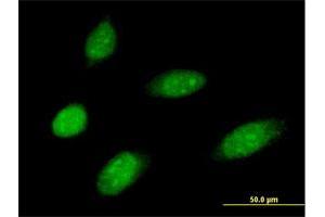 Immunofluorescence of purified MaxPab antibody to MMS19 on HeLa cell. (MMS19 antibody  (AA 1-293))