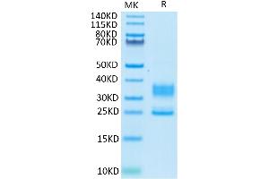 Human CD3E&CD3D on Tris-Bis PAGE under reduced condition. (CD3D & CD3E protein (His tag))