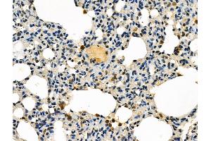 ABIN6257005 and ABIN6275940 at 1/100 staining Rat spleen tissue by IHC-P.