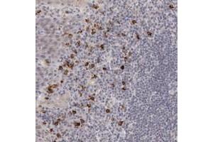 Immunohistochemical staining of human tonsil with RGAG1 polyclonal antibody  shows strong cytoplasmic positivity in a subset of lymphoid cells outside reaction centra). (RGAG1 antibody)