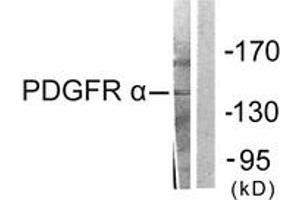 Western Blotting (WB) image for anti-Platelet Derived Growth Factor Receptor alpha (PDGFRA) (AA 1031-1080) antibody (ABIN2889249) (PDGFRA antibody  (AA 1031-1080))