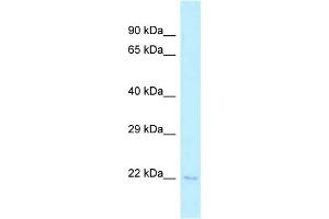 WB Suggested Anti-Tsen15 Antibody Titration: 1. (TSEN15 antibody  (C-Term))