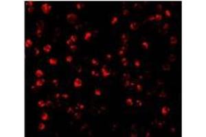 Immunofluorescence of ATF6 in MCF7 cells with this product atF6 antibody at 10 µg/ml. (ATF6 antibody  (C-Term))