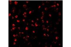 Immunofluorescence (IF) image for anti-Activating Transcription Factor 6 (ATF6) (C-Term) antibody (ABIN499351)