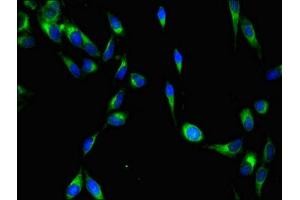 Immunofluorescence (IF) image for anti-V-Yes-1 Yamaguchi Sarcoma Viral Oncogene Homolog 1 (YES1) (AA 1-155) antibody (ABIN7174080)