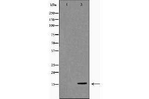 Western blot analysis on COLO205 cell lysate using Histone H3 Antibody，The lane on the left is treated with the antigen-specific peptide. (Histone 3 antibody)