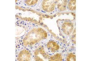 Immunohistochemistry of paraffin-embedded human kidney using UBA6 antibody (ABIN5975585) at dilution of 1/100 (40x lens). (UBA6 antibody)