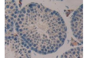 Immunohistochemistry (IHC) image for anti-Coagulation Factor XIII, A1 Polypeptide (F13A1) (AA 372-616) antibody (ABIN7442897)