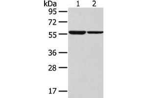 Gel: 8 % SDS-PAGE, Lysate: 40 μg, Lane 1-2: K562 and hepg2 cell, Primary antibody: ABIN7192521(SLC7A11 Antibody) at dilution 1/300 dilution, Secondary antibody: Goat anti rabbit IgG at 1/8000 dilution, Exposure time: 30 seconds (SLC7A11 antibody)