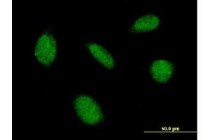 Immunofluorescence of purified MaxPab antibody to CAMK4 on HeLa cell. (CAMK4 antibody  (AA 1-473))