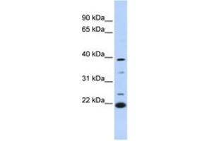 Image no. 1 for anti-Penta-EF-Hand Domain Containing 1 (PEF1) (AA 180-229) antibody (ABIN6744280) (PEF1 antibody  (AA 180-229))