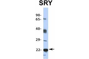Host:  Rabbit  Target Name:  SRY  Sample Type:  HepG2  Antibody Dilution:  1. (SRY antibody  (Middle Region))