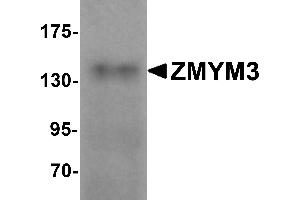 Western Blotting (WB) image for anti-Zinc Finger Protein 261 (ZMYM3) (C-Term) antibody (ABIN1030826) (ZMYM3 antibody  (C-Term))