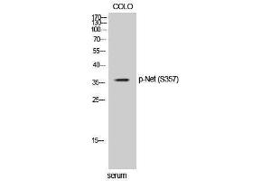 Western Blotting (WB) image for anti-ELK3, ETS-Domain Protein (SRF Accessory Protein 2) (ELK3) (pSer357) antibody (ABIN3182797) (ELK3 antibody  (pSer357))