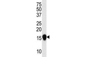 Western blot analysis of SUMO4 antibody (V55 Mutant) in HepG2 lysate. (SUMO4 antibody  (Met55Val-Mutant))