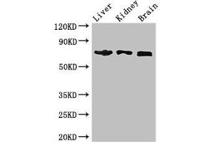 Western Blot Positive WB detected in: Mouse liver tissue, Mouse kidney tissue, Mouse brain tissue All lanes: TCF4 antibody at 2.