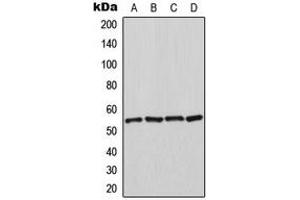 Western blot analysis of HSPA14 expression in K562 (A), HeLa (B), NIH3T3 (C), rat kidney (D) whole cell lysates. (HSPA14 antibody  (C-Term))