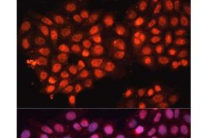 Immunofluorescence analysis of HeLa cells using ABCB8 Polyclonal Antibody at dilution of 1:100 (40x lens). (ABCB8 antibody)