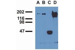 Western Blotting (WB) image for anti-Epidermal Growth Factor Receptor (EGFR) (pTyr1016) antibody (ABIN400878) (EGFR antibody  (pTyr1016))