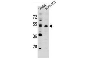Western blot analysis of KCMF1 antibody (C-term) Cat.