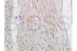 Formalin-fixed and paraffin embedded rat heart labeled with Anti Connexin-37/GJA4 Polyclonal Antibody, Unconjugated (ABIN753343) at 1:200 followed by conjugation to the secondary antibody and DAB staining