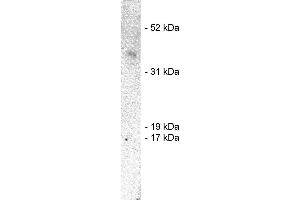 Western blot using  X1859P, rabbit polyclonal at 1  ug/ml on human brain lysate (20 ug/lane). (SIAH1 antibody)