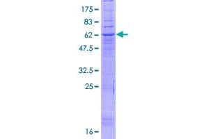 Progestin and AdipoQ Receptor Family Member IX (PAQR9) (AA 1-377) protein (GST tag)