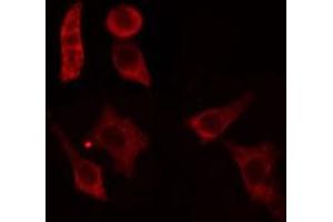 ABIN6279106 staining HepG2 cells by IF/ICC. (ACER1 antibody  (Internal Region))