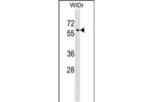 Western blot analysis in WiDr cell line lysates (35ug/lane). (SNX18 antibody  (C-Term))